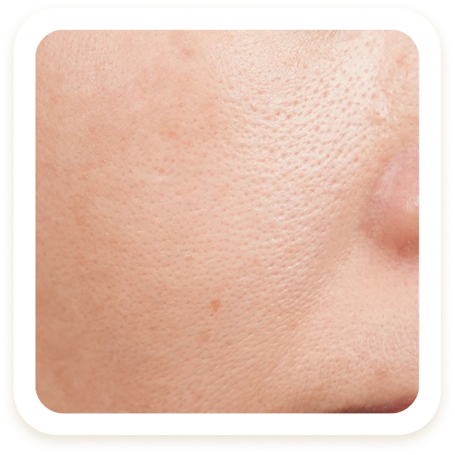 Da thiếu sức sống