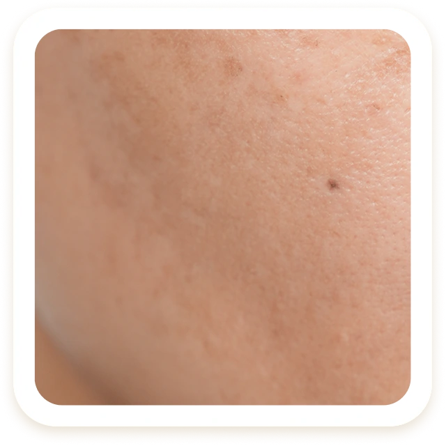 Da thiếu sức sống