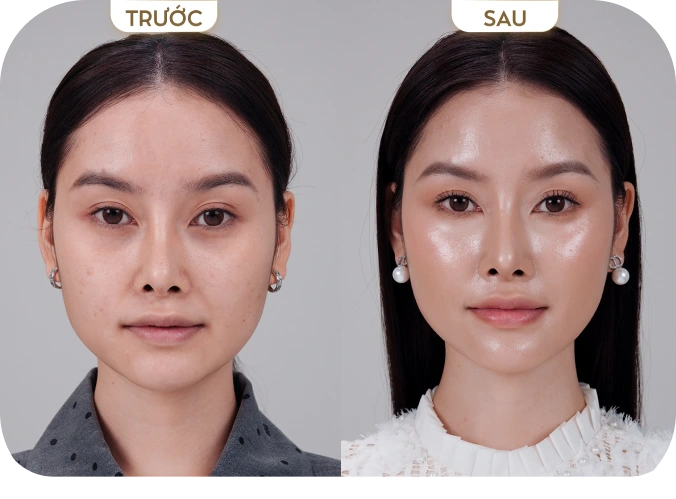 Nguyễn Trần Mỹ Anh [TP.HCM]