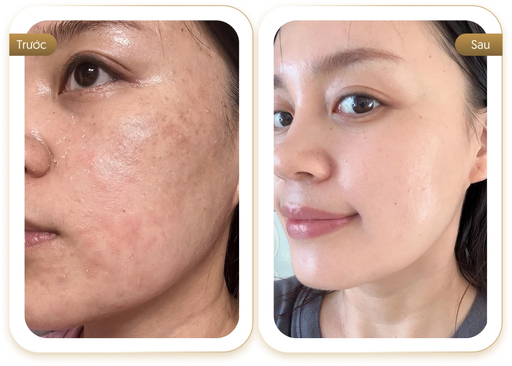 Feedback