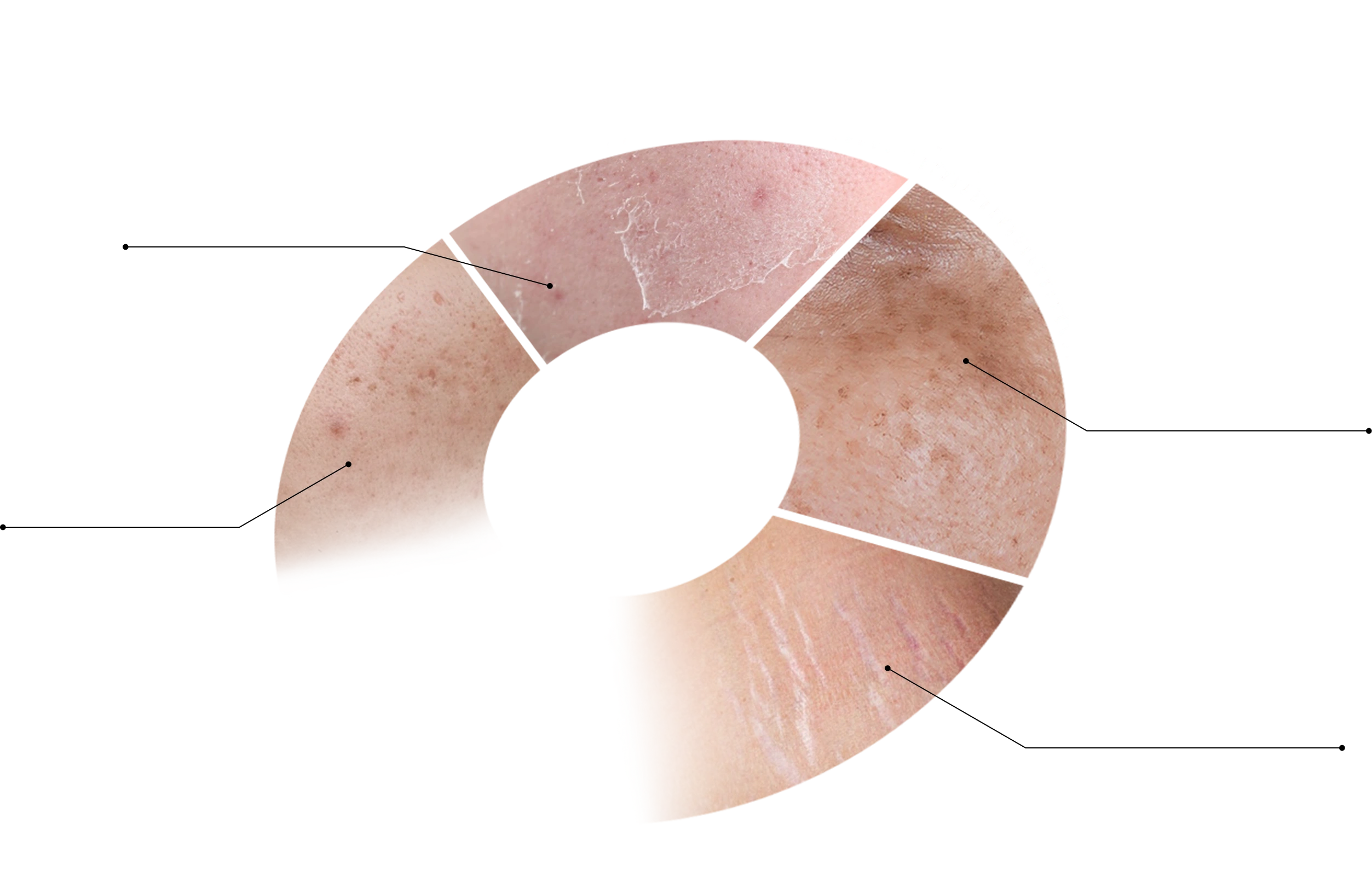 Target Skin Sections