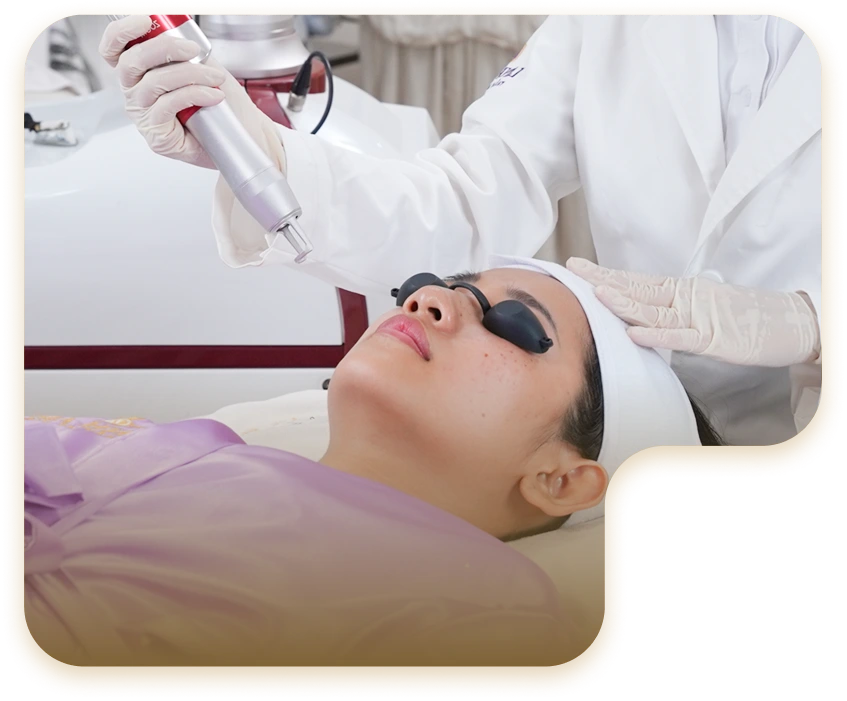 XÓA NỐT RUỒI