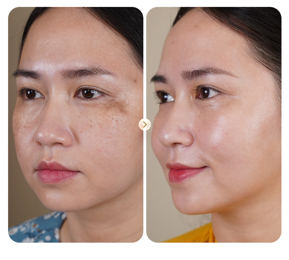 Kết quả khách hàng