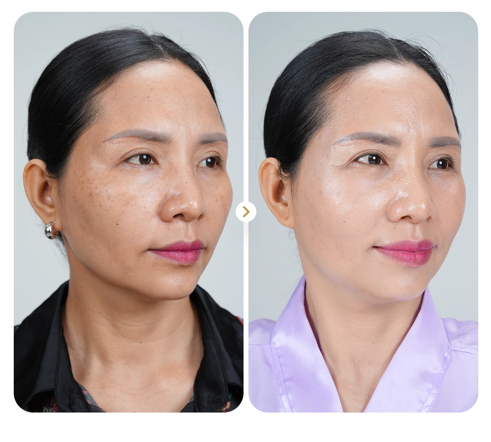 Kết quả khách hàng