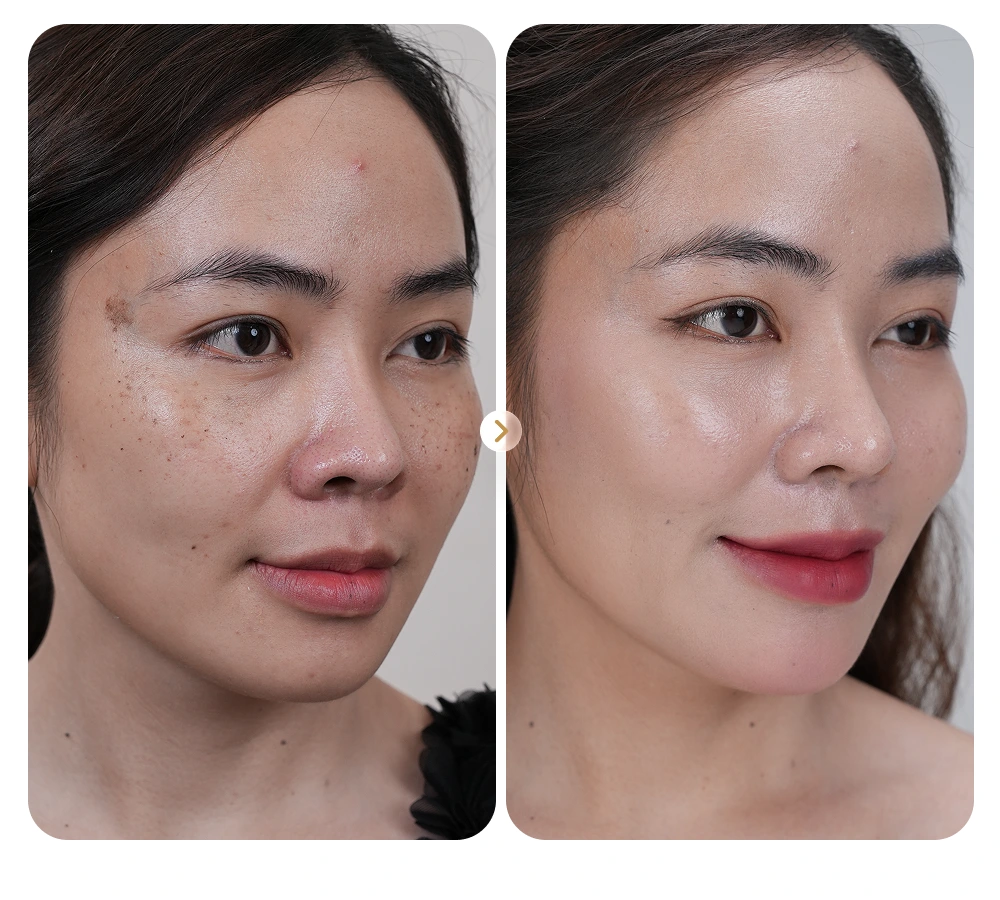 Kết quả khách hàng