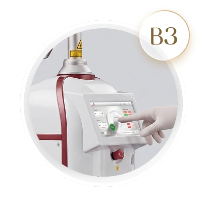Chuẩn bị dụng cụ cần thiết như máy laser, kính bảo hộ