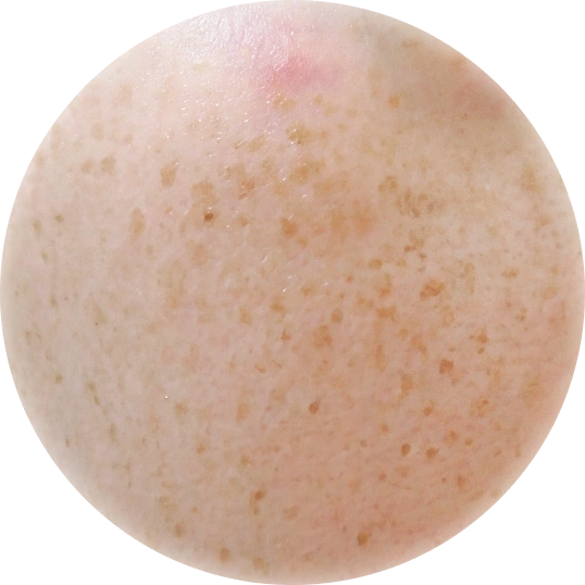 Sắc tố