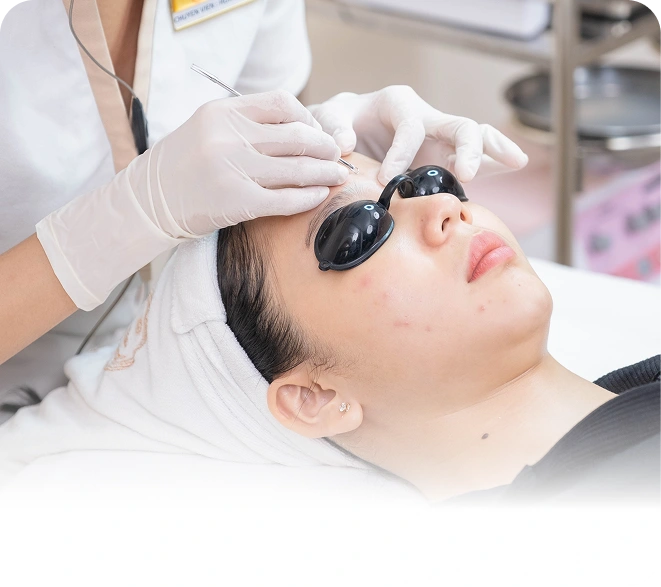 Tiến hành lấy nhân mụn chuẩn y khoa