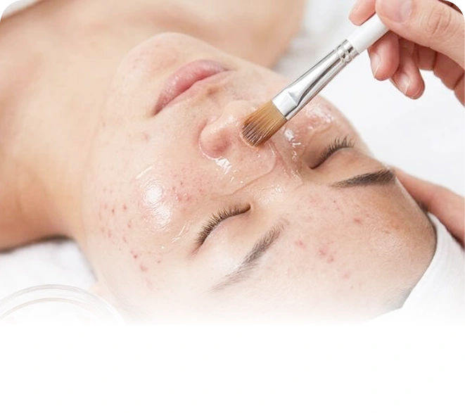 Liệu trình điều trị mụn chuyên sâu theo chỉ định bác sĩ