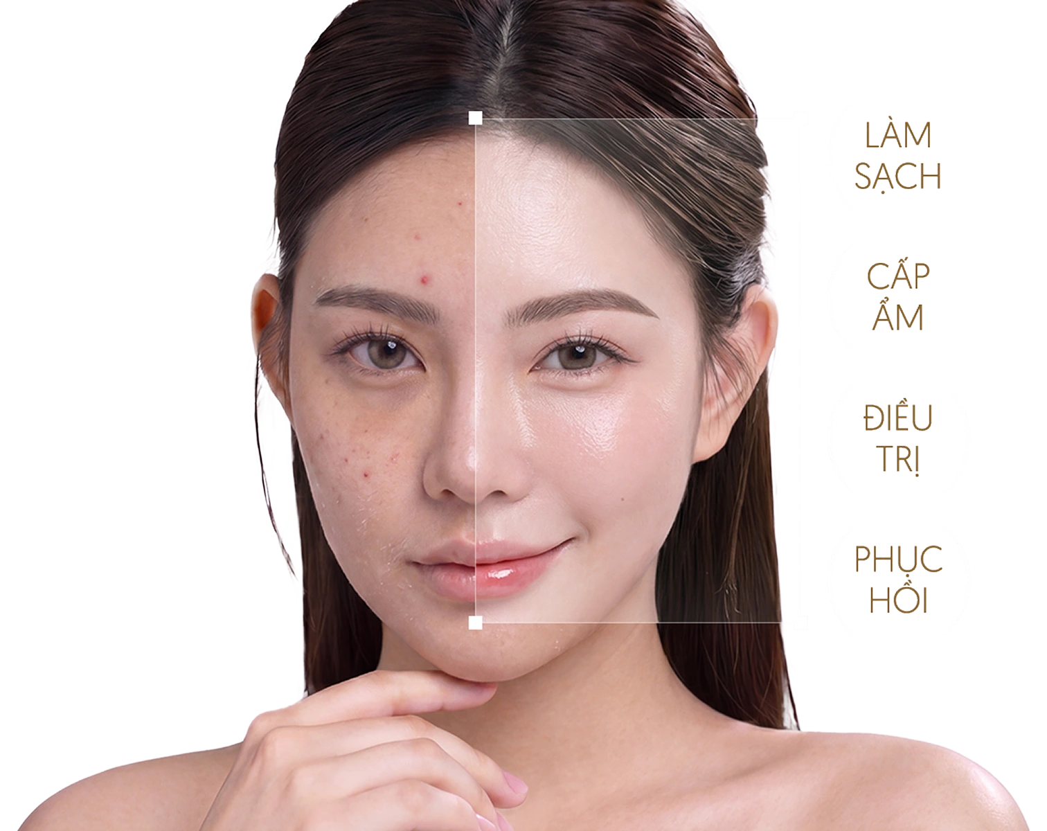 Mẫu chăm sóc da chuyên sâu tại Linh Anh