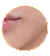 Icon da khô mất nước bong tróc