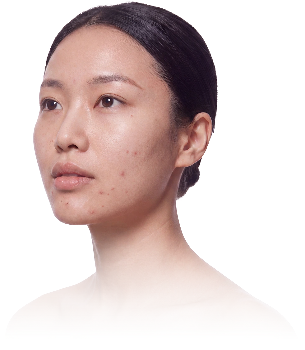 Mẫu nữ có tình trạng da cần chăm sóc chuyên sâu