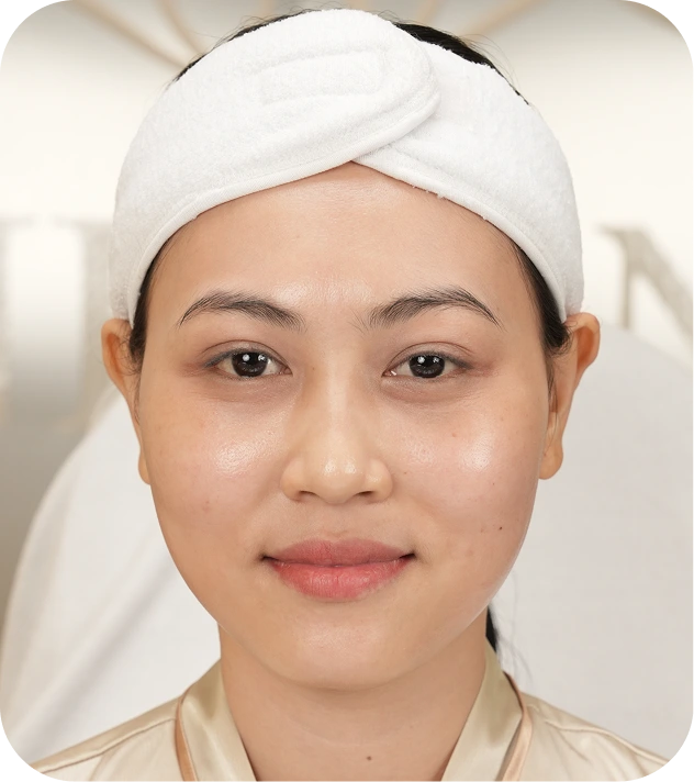 Làn da sau phục hồi của khách hàng Thuý Trâm