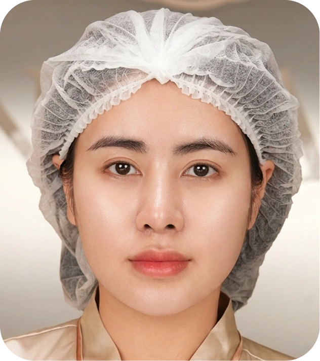 Làn da sau phục hồi của khách hàng Thoại Vy