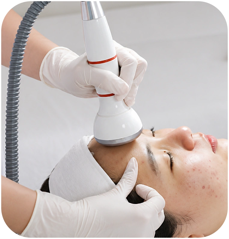Điện di điều trị mụn