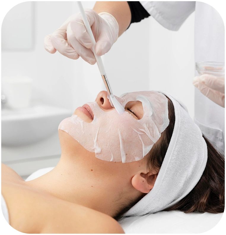 Peel da điều trị mụn