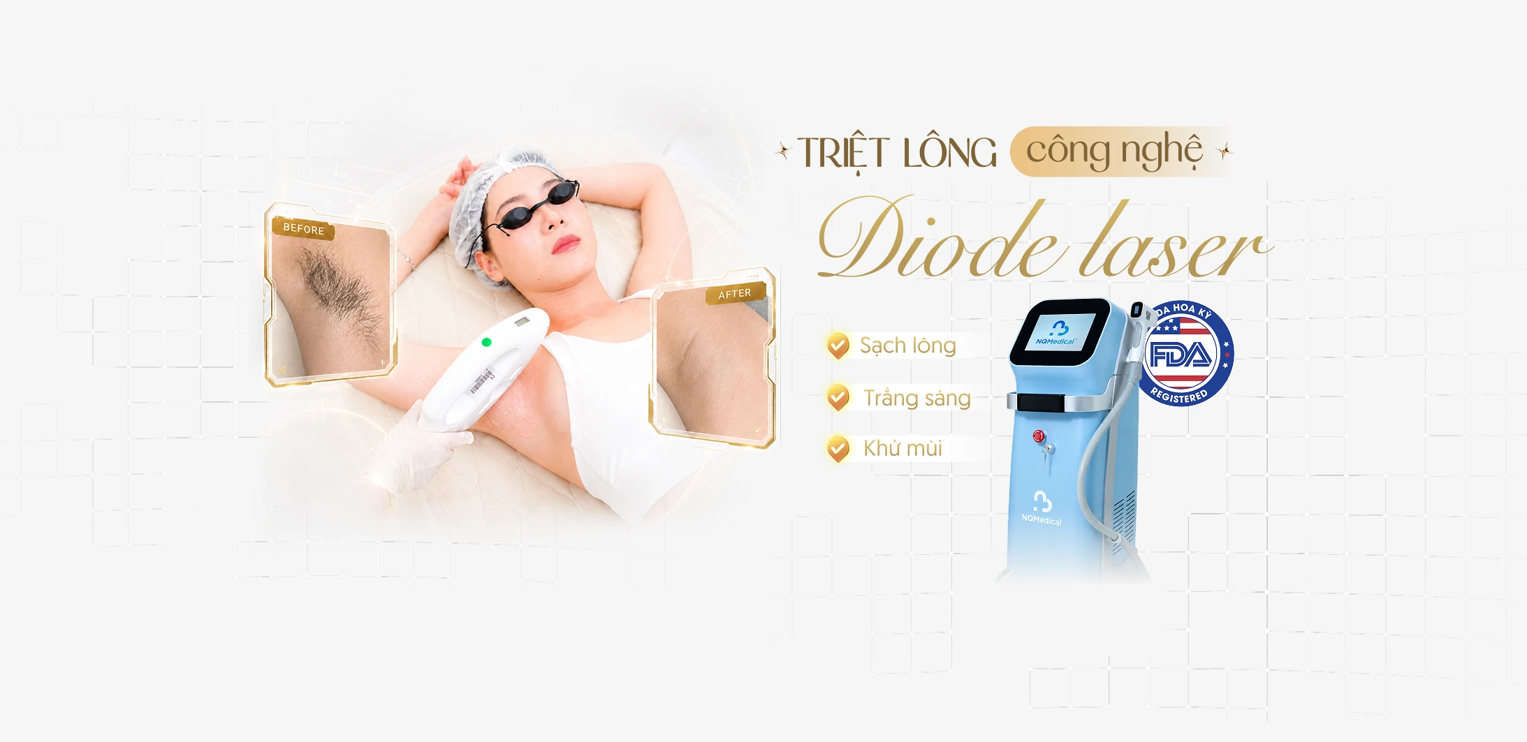 Triệt lông công nghệ Diode Laser tại Linh Anh