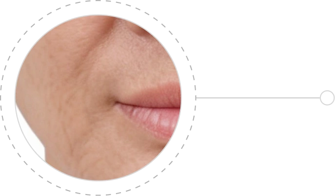 Da chảy xệ, kém đàn hồi