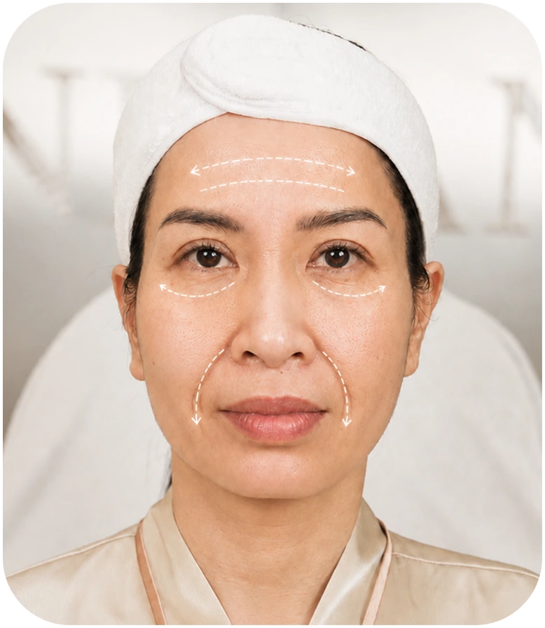 Xóa nếp nhăn