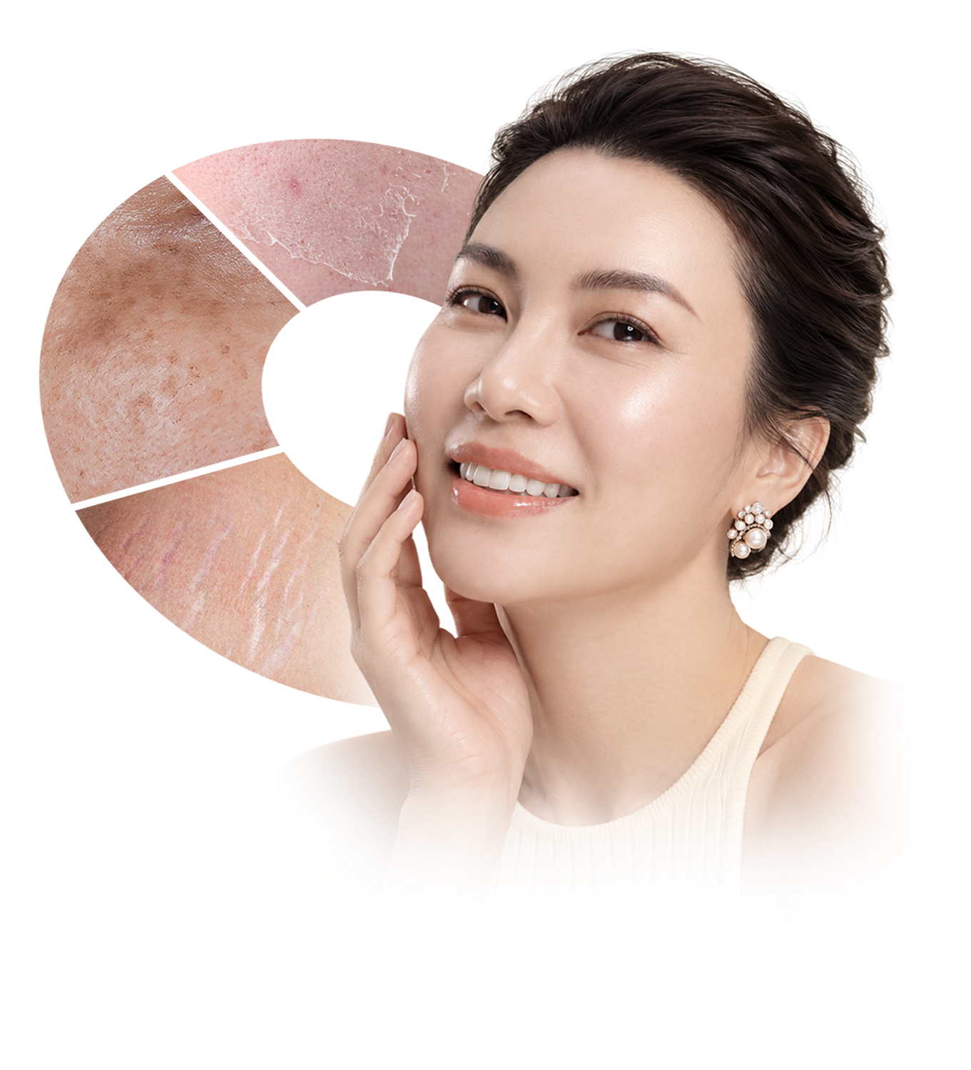 Laser Fotona – hệ thống laser đa ứng dụng cho nhiều vấn đề da